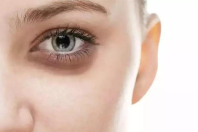 GÖZ ÇEVRESİNDE YAŞLANMANIN ÖNLENMESİ İÇİN NELER YAPILABİLİR?