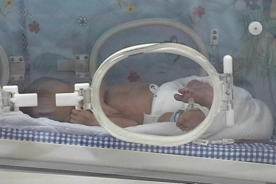 AYM'den kolu olmayan bebek kararı