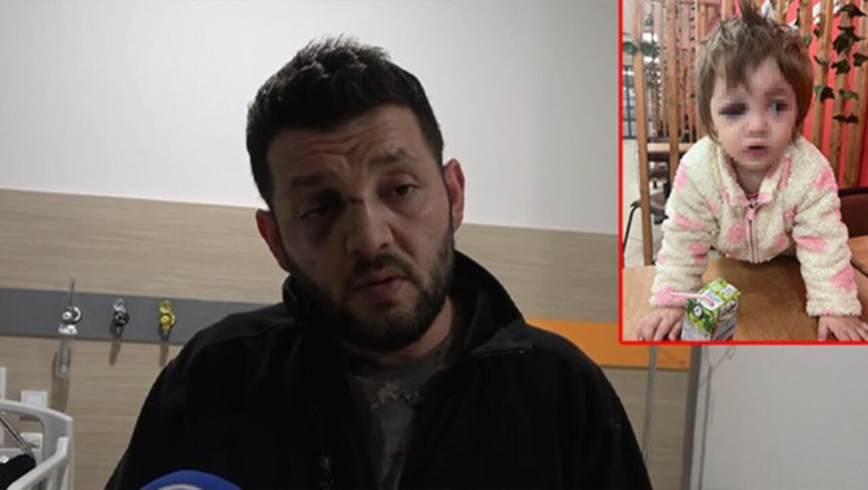 Yalova’da Saldırıya Uğrayan Babadan Teşekkür