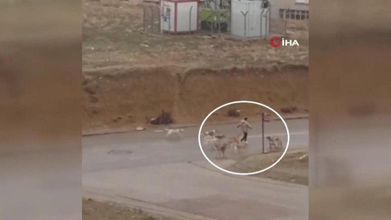 Ankara'da küçük çocuk köpek saldırısına uğradı