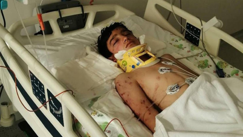 Sokak köpeklerinin saldırdığı Hayrettin'in yoğun bakımda tedavisi sürüyor