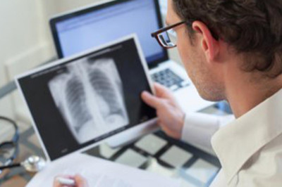 Verem Eğitimi ve Farkındalık Haftası Başladı