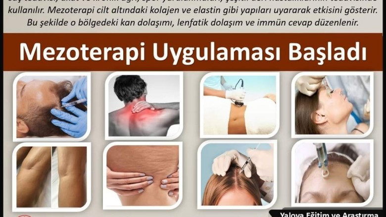 YALOVA EĞİTİM VE ARAŞTIRMA HASTANESİNDE MEZOTERAPİ UYGULAMASI BAŞLADI