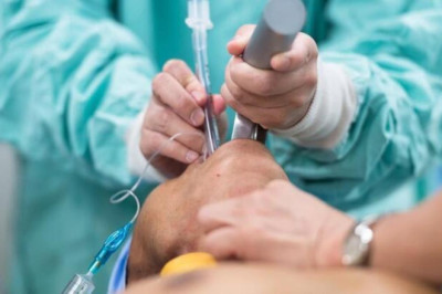 Entübe ne demek, entübe etmek nedir? Entübe hasta nedir? Entübe hasta resmi