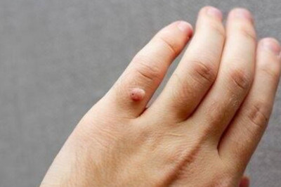 Siğil Duası Türkçe, Arapça Okunuşu ve Anlamı: Siğilin Geçmesi İçin Okunacak Dualar Nelerdir?