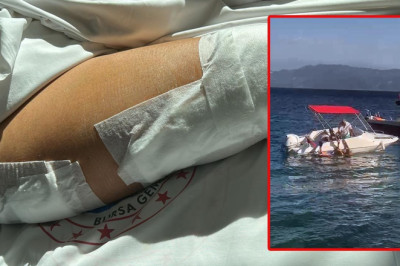 Yalova'da Sürat Teknesinin Çarptığı Yaşlı Kadın Ağır Yaralandı